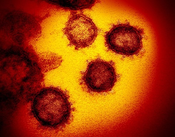 Phát hiện virus corona đột biến, có khả năng lây lan mạnh hơn trước-1