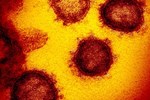 Các nhà khoa học Hà Lan phát hiện ra kháng thể có thể vô hiệu hóa virus SARS-CoV-2-2