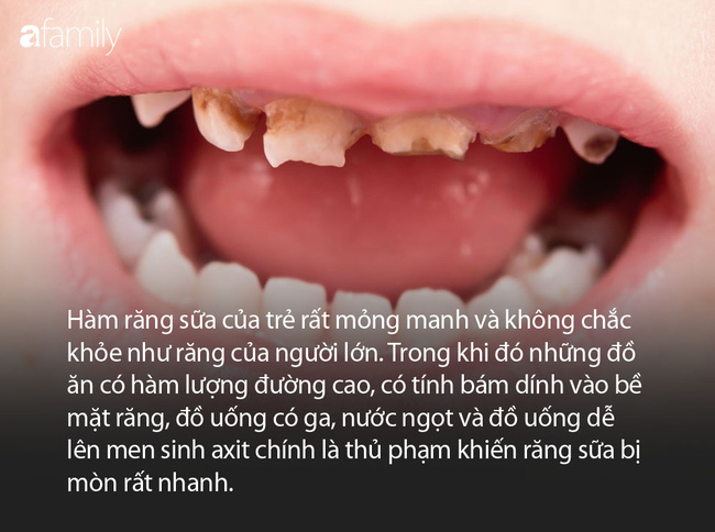 Con có hàm răng như răng cá mập, bà mẹ hối hận vì nguyên nhân là do mình-3