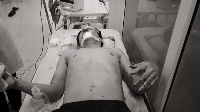 Vợ chồng bị truy sát giữa trưa ở Hà Tĩnh: Tình nghi kẻ gây án là chồng cũ nữ nạn nhân-2