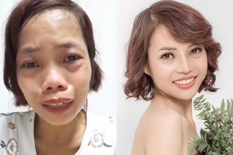 Cô gái Đồng Nai đổi đời sau 24 năm bị miệt thị người không môi-4