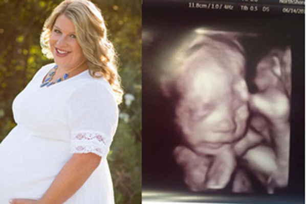 Thiếu nữ 16 tuổi tuyên bố mang bầu 3 thai, gia đình và bạn trai chưa hết ngạc nhiên thì sự thật đằng sau được phơi bày-3