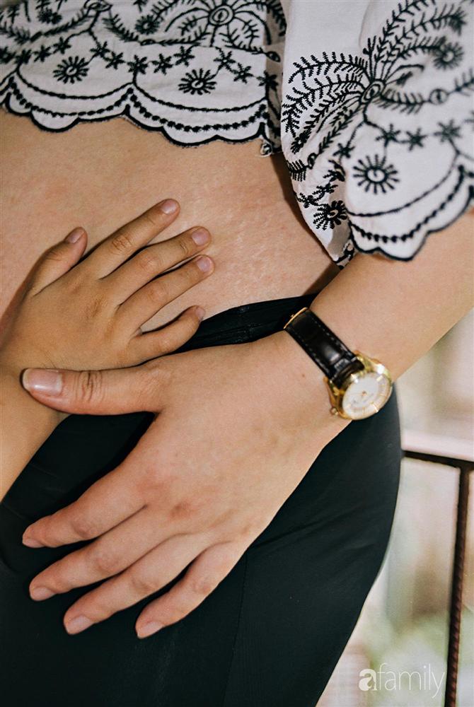 Vết nứt của đá trên bụng mẹ-9