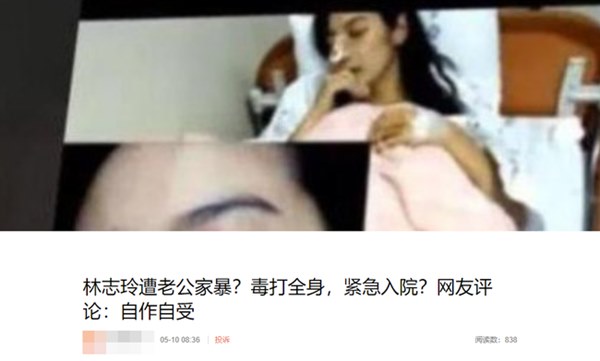 Nữ hoàng nội y Đài Loan Lâm Chí Linh bị ông xã kém tuổi bạo hành tới mức nhập viện?-1