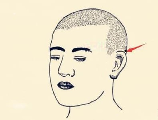 Nốt ruồi tài lộc là gì? Ở những vị trí nào trên cơ thể của bạn có nốt ruồi tài lộc-2