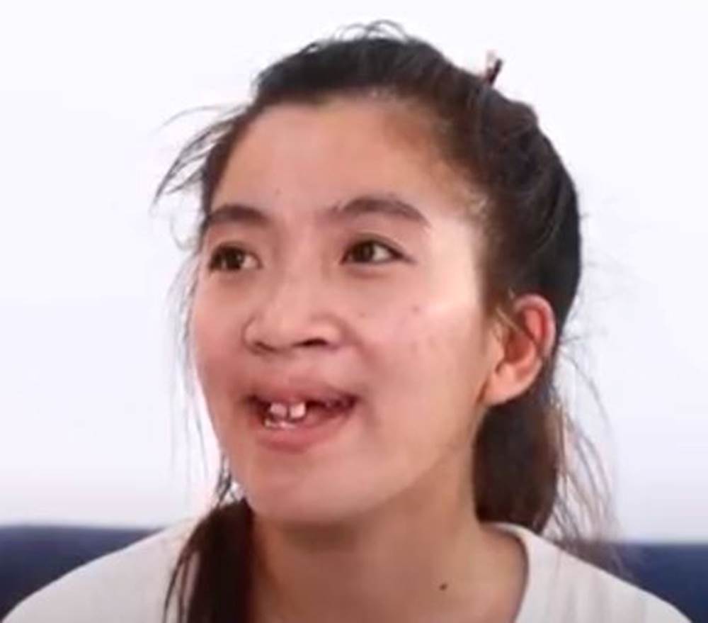 Cô gái hàm ếch bị trêu là đứa không môi lột xác xinh đẹp và giọt nước mắt của người cha tần tảo khiến nhiều người xúc động-1