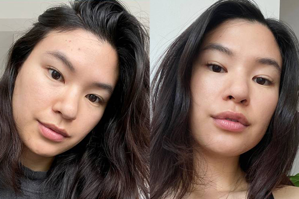 4 mẹo chăm da được chị em truyền tai nhau từ năm này qua tháng khác nhưng bác sĩ da liễu lại kịch liệt phản đối-5