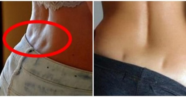 2 lúm đồng tiền sau lưng không chỉ là biểu tượng của sự gợi cảm mà còn là dấu hiệu tiết lộ tình trạng sức khỏe-3