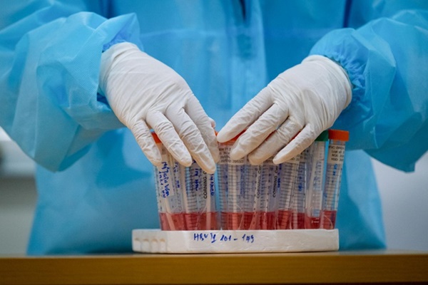 Bệnh nhân 91 sẽ chết nếu chấm dứt ECMO-1