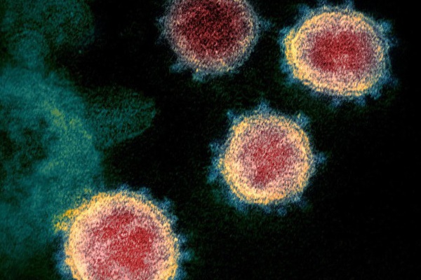 WHO cảnh báo virus SARS CoV-2 có thể không bao giờ biến mất-1