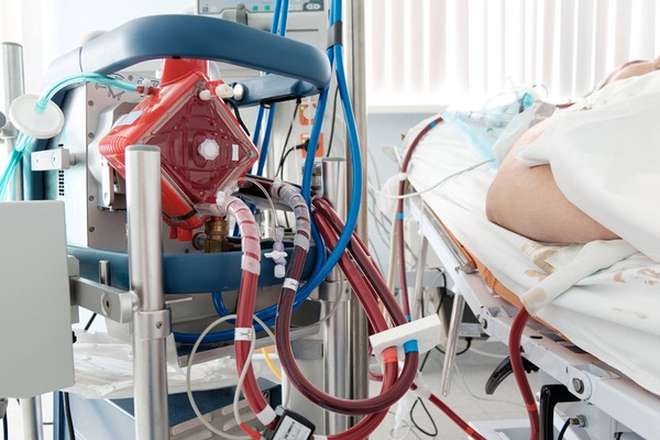 20 người tình nguyện hiến 1 thuỳ phổi cho bệnh nhân mắc Covid-19 nặng nhất Việt Nam-1