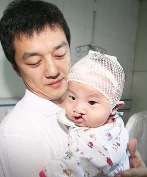 Sinh ra với dị tật hở hàm ếch nhưng con gái nam diễn viên nổi tiếng càng lớn càng xinh xắn tự tin, tất cả nhờ cách dạy của bố-1