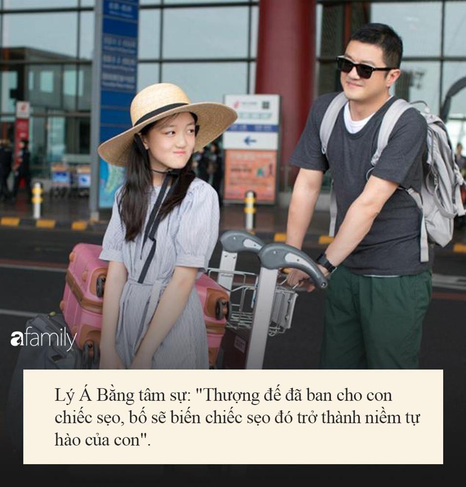 Sinh ra với dị tật hở hàm ếch nhưng con gái nam diễn viên nổi tiếng càng lớn càng xinh xắn tự tin, tất cả nhờ cách dạy của bố-10