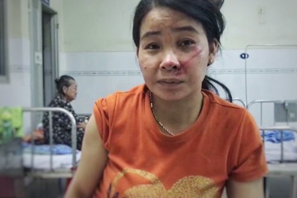 Tang thương cảnh vợ nghẹn ngào đến nhận xác chồng trong vụ sập công trình nghiêm trọng ở Đồng Nai-6