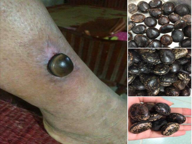 Sự thật về hạt đậu Lào có giá cắt cổ vẫn được nhiều người lùng mua-3