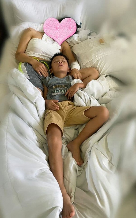 Sau một tuần bị bỏng nặng, Hồng Ngọc chia sẻ hình ảnh đầu tiên, nhìn mà thương-1