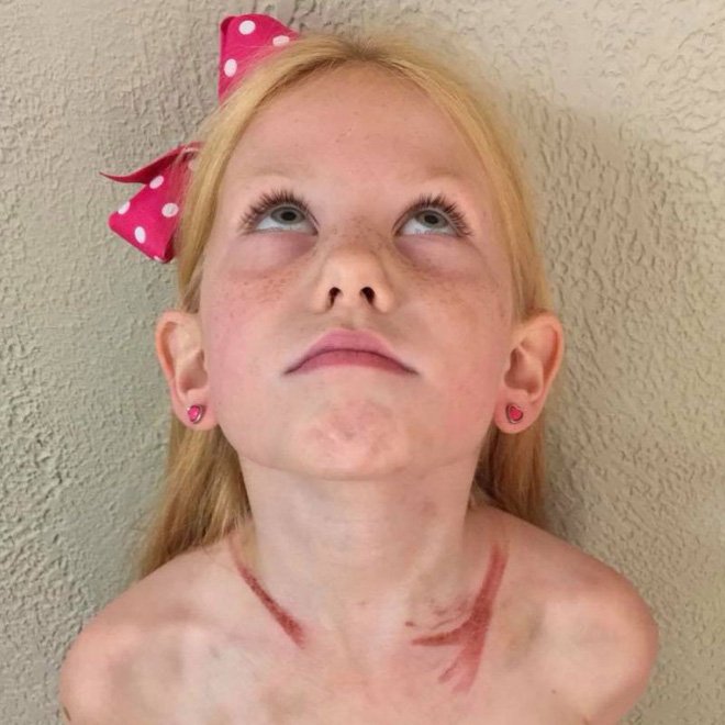 Ô tô gia đình gặp tai nạn nghiêm trọng, bé gái 6 tuổi trở thành anh hùng nhanh trí cứu các em thoát nạn-3