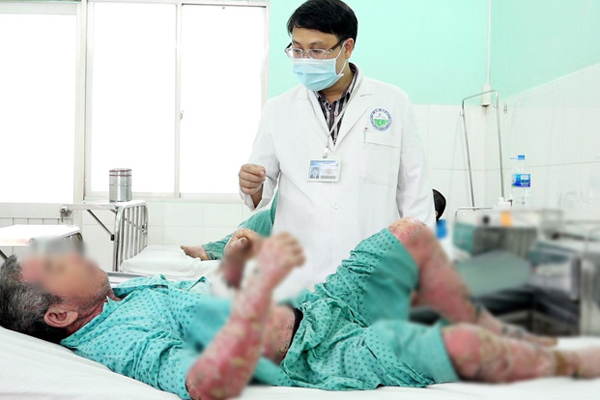 Vảy nến rụng thành chén vì mua thuốc quảng cáo trên mạng-3