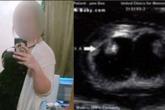 Thiếu nữ 16 tuổi tuyên bố mang bầu 3 thai, gia đình và bạn trai chưa hết ngạc nhiên thì sự thật đằng sau được phơi bày