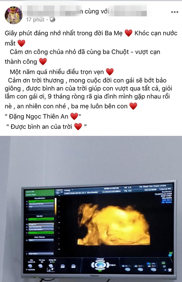 Người đàn ông Việt Nam đầu tiên mang thai đã vượt cạn thành công, tên em bé được mẹ tiết lộ có ý nghĩa bất ngờ-5