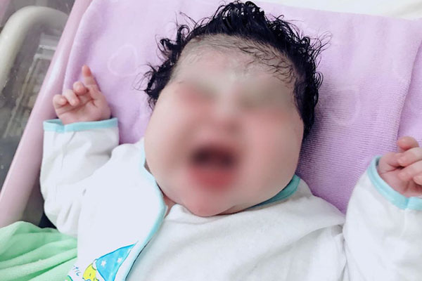 Hiếm gặp: Sản phụ Sóc Trăng mang thai lần 7 hạ sinh em bé nặng 6,1kg-1