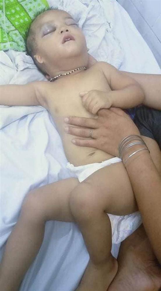 Hy hữu chuyện cháu bé 2 tuổi ở Quảng Nam gặp nạn trên trời rơi xuống-1