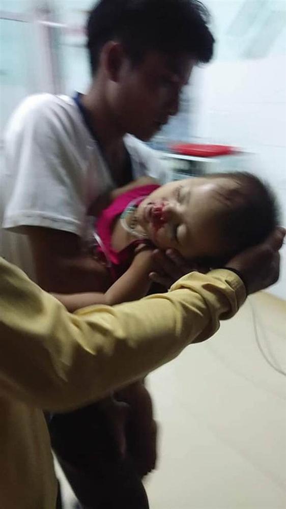 Hy hữu chuyện cháu bé 2 tuổi ở Quảng Nam gặp nạn trên trời rơi xuống-2
