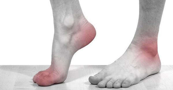 4 dấu hiệu xuất hiện ở chân cảnh báo nhiều bệnh nguy hiểm-1