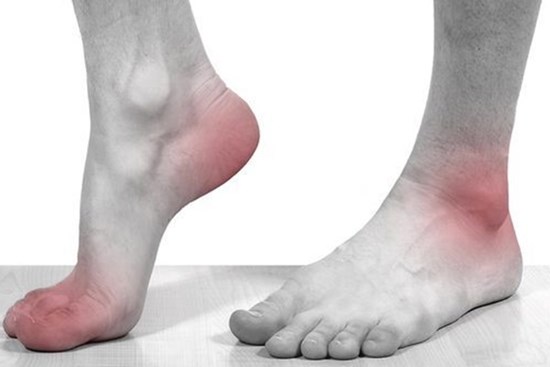 4 dấu hiệu xuất hiện ở chân cảnh báo nhiều bệnh nguy hiểm