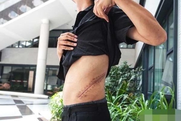 Chàng trai bán thận để mua iPhone 4 chín năm trước giờ ra sao-1