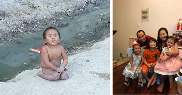 Em bé Mường Lát bị liệt 2 chân ngày nào đã thay đổi hoàn toàn sau gần 3 năm được nhận nuôi-2