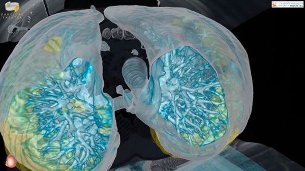 Chuyên gia nói về sự tàn phá của Covid-19 khiến người bệnh đau đớn kinh khủng, tuyệt vọng, hoang mang tột độ-2