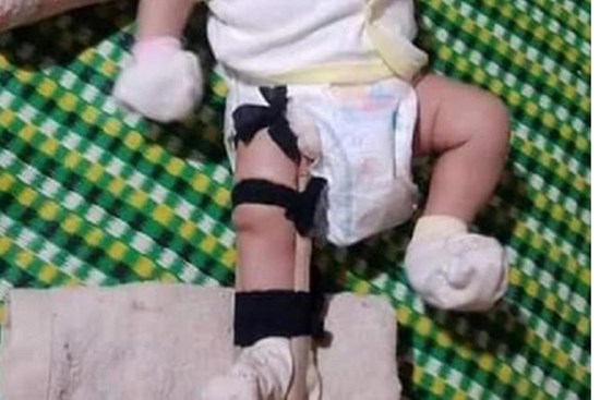 Lời khai của người cha nghi đánh con ruột 2 tháng tuổi gãy chân