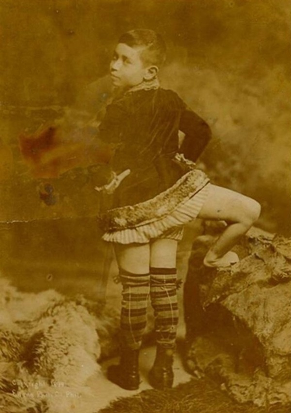 Cuộc đời dị nhân 3 chân và 2 của quý: Cả đời đi mua vui nhưng không giữ được vợ-2