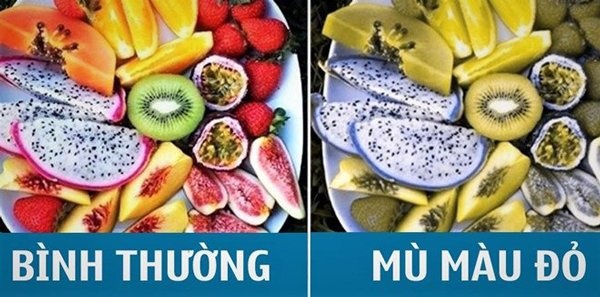 4 căn bệnh dễ di truyền cho nam hơn nữ, vợ chồng nếu mắc phải nên mong sinh con gái-3