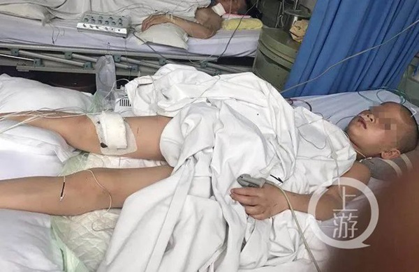 Gửi con cho vợ cũ chăm sóc, bố nhận tin đứa trẻ có thể bị liệt và phát hiện việc làm tàn nhẫn của cha dượng đứa bé-2