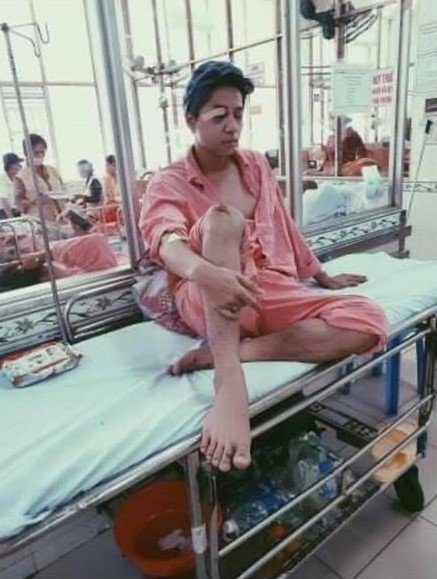 Ca sĩ Bùi Duy Ngọc chấn thương não, liệt nửa mặt vì tai nạn-1