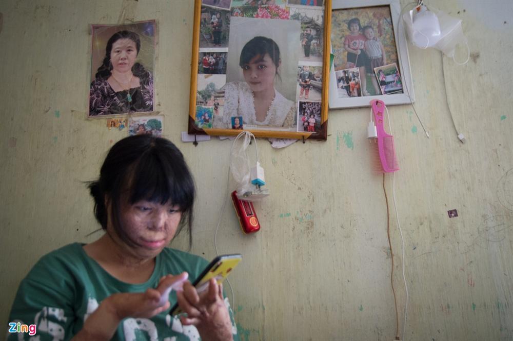 4 năm tìm lại bình yên của cô gái bị chồng tưới xăng thiêu sống-2