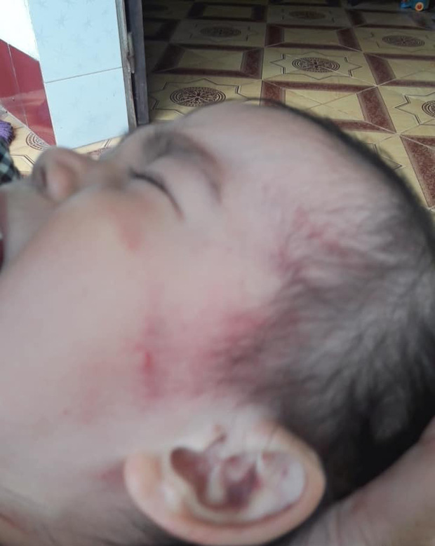 Bắc Giang: Nghi vấn cơ sở mầm non tư thục bạo hành dã man bé gái hơn 2 tuổi khi mới nhập học 3 ngày-4