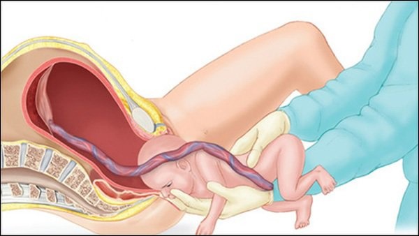 Mẹ thay bỉm, con khóc thét, ngỡ ngàng phát hiện đây là dấu hiệu bệnh gây tàn tật suốt đời-3