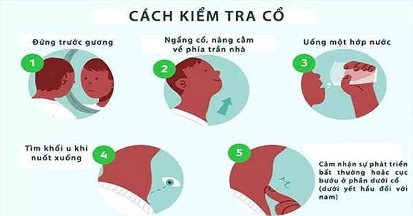 Tự kiểm tra bệnh tuyến giáp nhờ 1 cốc nước, làm ngay kẻo nhỡ ung thư để lâu khó chữa-2