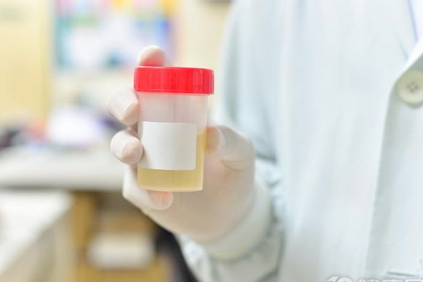 Nhiều trẻ đến viện vì đi tiểu máu, nhưng bác sĩ lý giải nguyên nhân hóa ra rất đơn giản-3