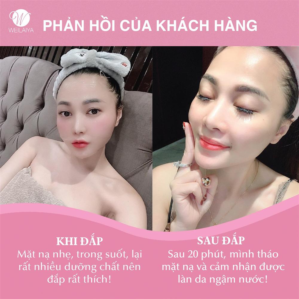 Bạn có biết loại mặt nạ nào đang dậy sóng trong giới làm đẹp hiện nay?-4