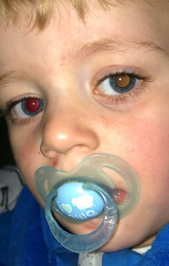 Thấy mắt của con trai đổi màu trong các bức ảnh, bà mẹ trẻ không ngờ đó là dấu hiệu của bệnh ung thư hiếm gặp và ác tính-2