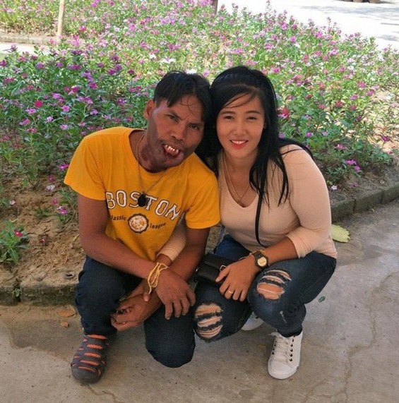 Cô gái lấy chàng trai dị tật 2 năm trước đã có chồng mới-1