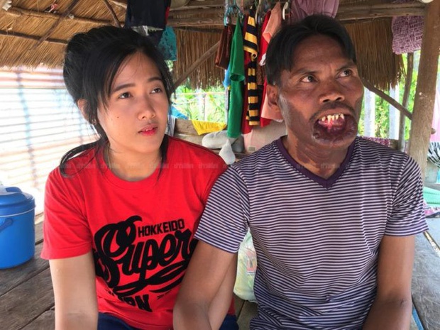 Cô gái lấy chàng trai dị tật 2 năm trước đã có chồng mới-2