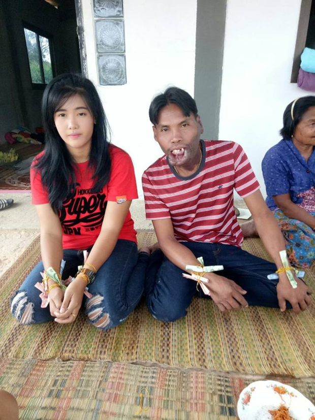 Cô gái lấy chàng trai dị tật 2 năm trước đã có chồng mới-5
