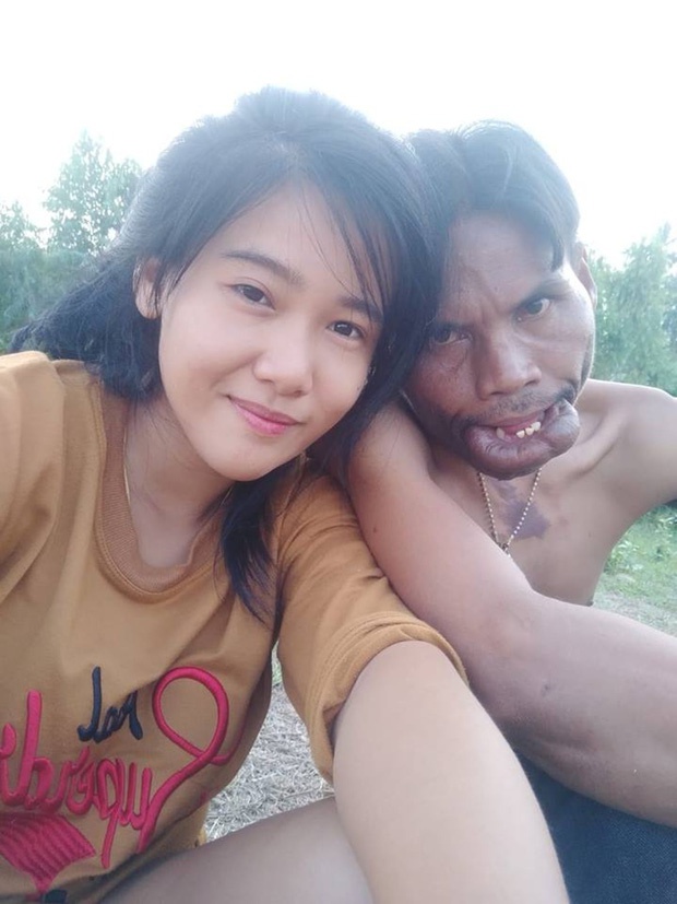 Cô gái lấy chàng trai dị tật 2 năm trước đã có chồng mới-4