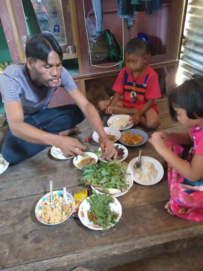 Cô gái lấy chàng trai dị tật 2 năm trước đã có chồng mới-7