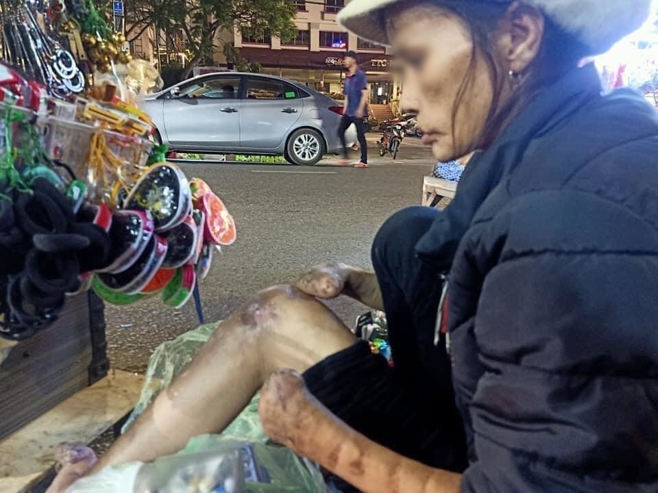Bé gái xinh như thiên thần cùng bà tật nguyền mưu sinh trong đêm Đà Lạt gây sốt MXH, khiến dân mạng tranh cãi gay gắt-2